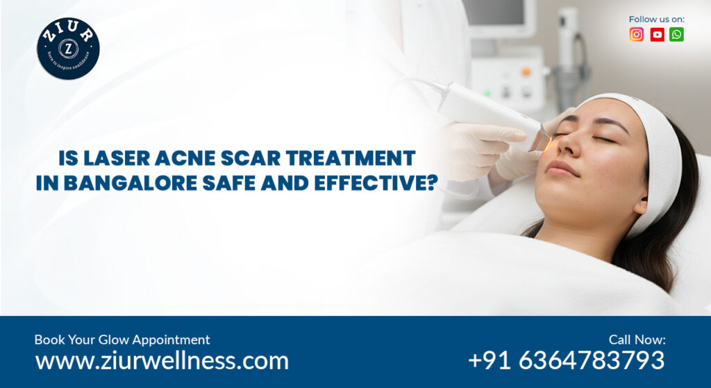 Acne scar treatment near me​ in bangalore