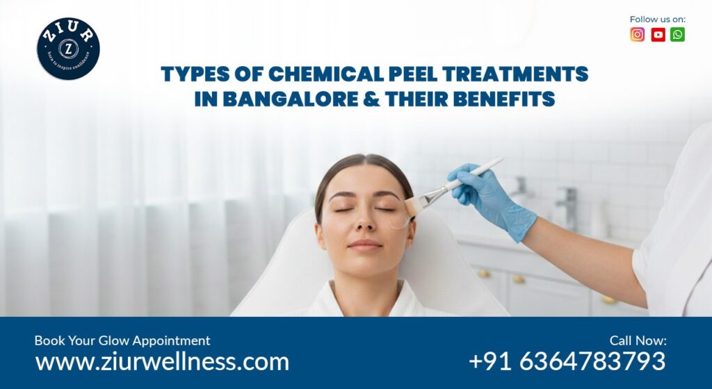 Chemical Peel Treatments in Bangalore