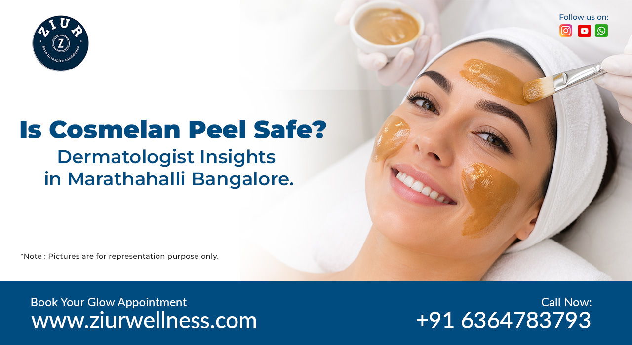 Cosmelan Peel in Marathahalli