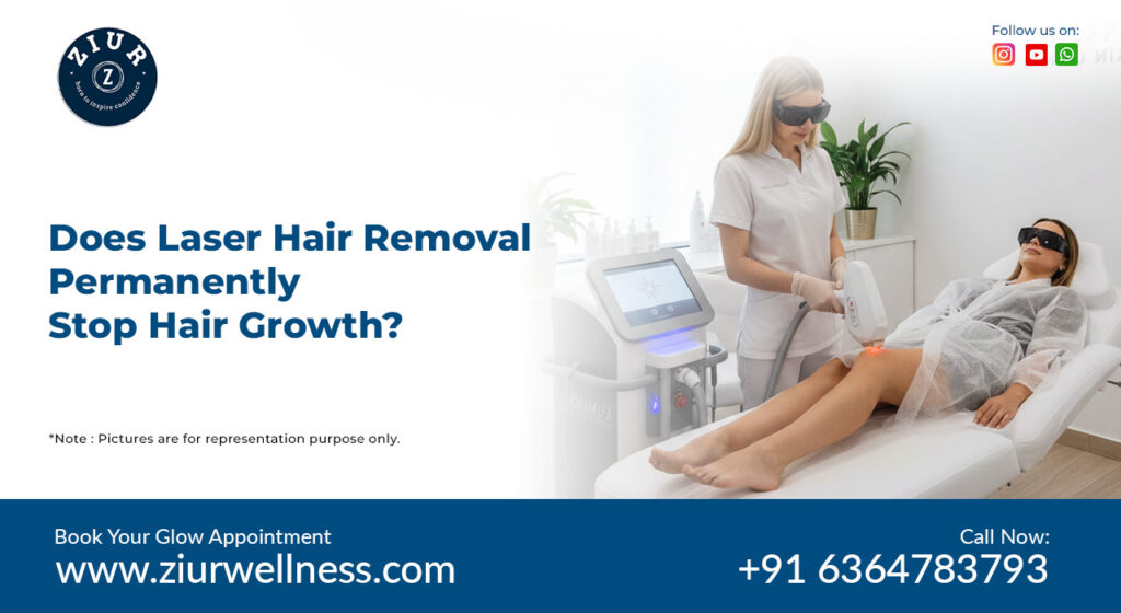 Laser hair removal in bangalore