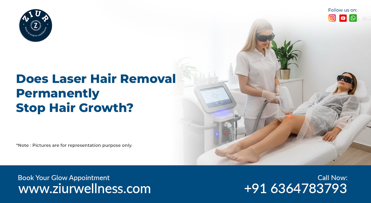 Laser hair removal in bangalore