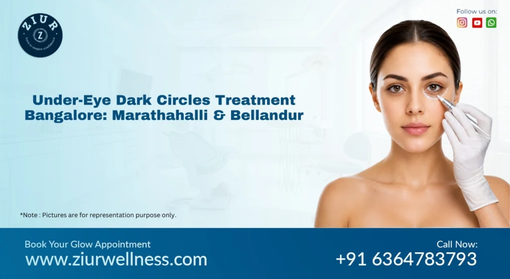 Under Eye Dark Circles Treatment in Marathahalli