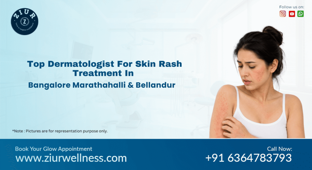 Skin Rashes Treatment in Marathahalli