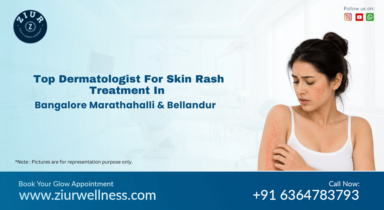 Skin Rashes Treatment in Marathahalli