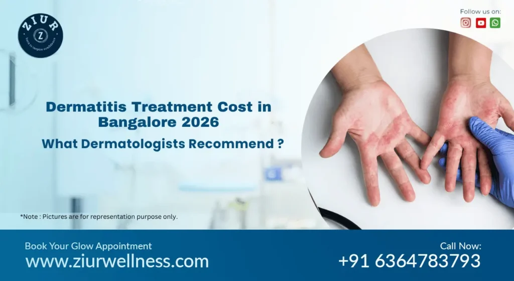 Dermatitis Treatment Cost in Bangalore