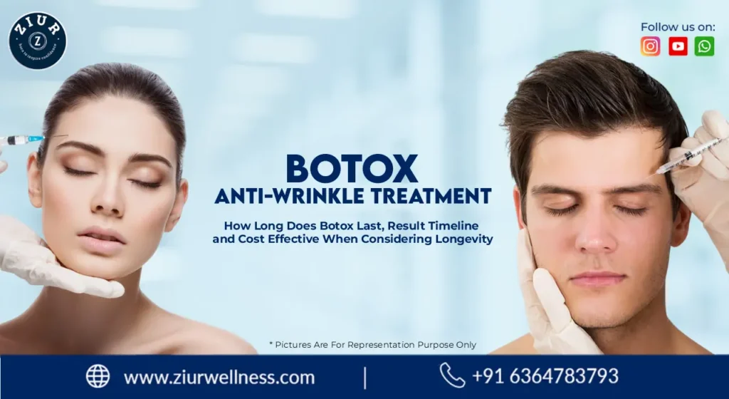Botox Anti Wrinkle Treatment in Bangalore