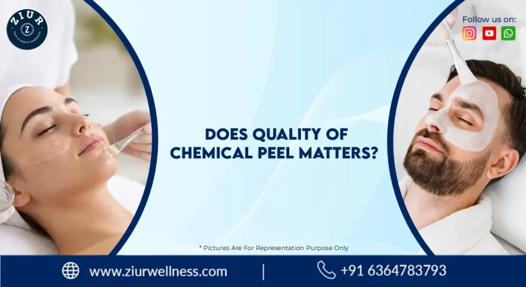 Chemical Peel Treatment in Marathahalli