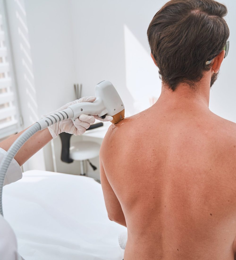 spa-client-undergoing-a-shoulder-laser-hair-remova-2021-09-15-21-57-46-utc-min